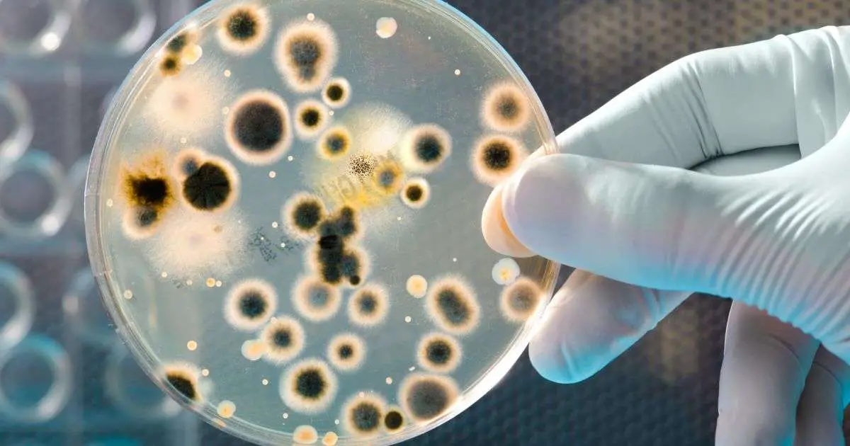 How To Test For Black Mold Let Sremovemold Mold Sample Testing