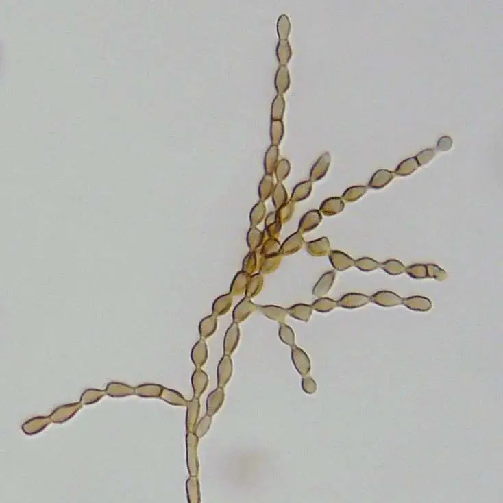 Cladosporium Spores